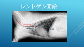 CT画像