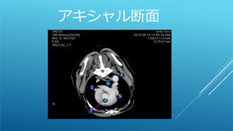 ＣＴ画像