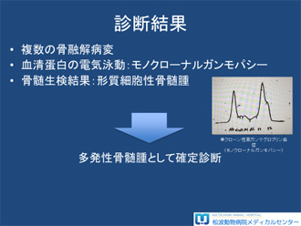 多発性骨髄腫