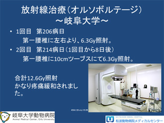 多発性骨髄腫