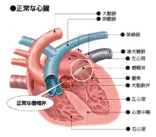 弁 不全 症 僧 閉鎖 帽 僧帽弁閉鎖不全症（MR）